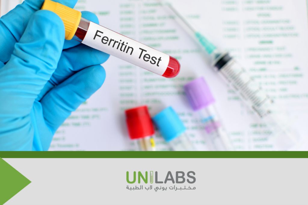 Understanding Your Iron Levels for Optimal Health: The Importance of the Ferritin Blood Test