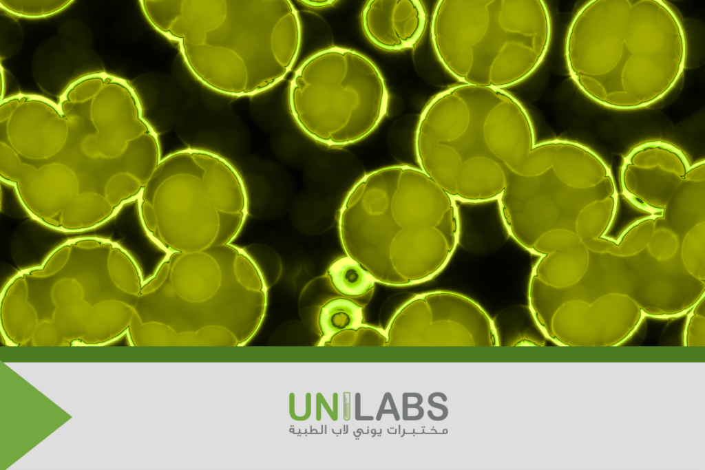 The Process of Testing for a Bacterial Infection