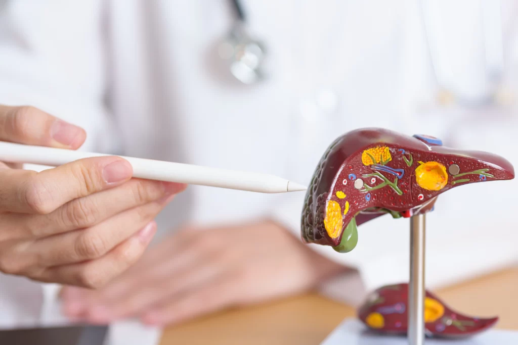 رسم توضيحي للكبد يظهر تراكم الدهون وأهم أعراض الكبد الدهني، مع مقارنة بين الكبد السليم والكبد المصاب بالدهون.