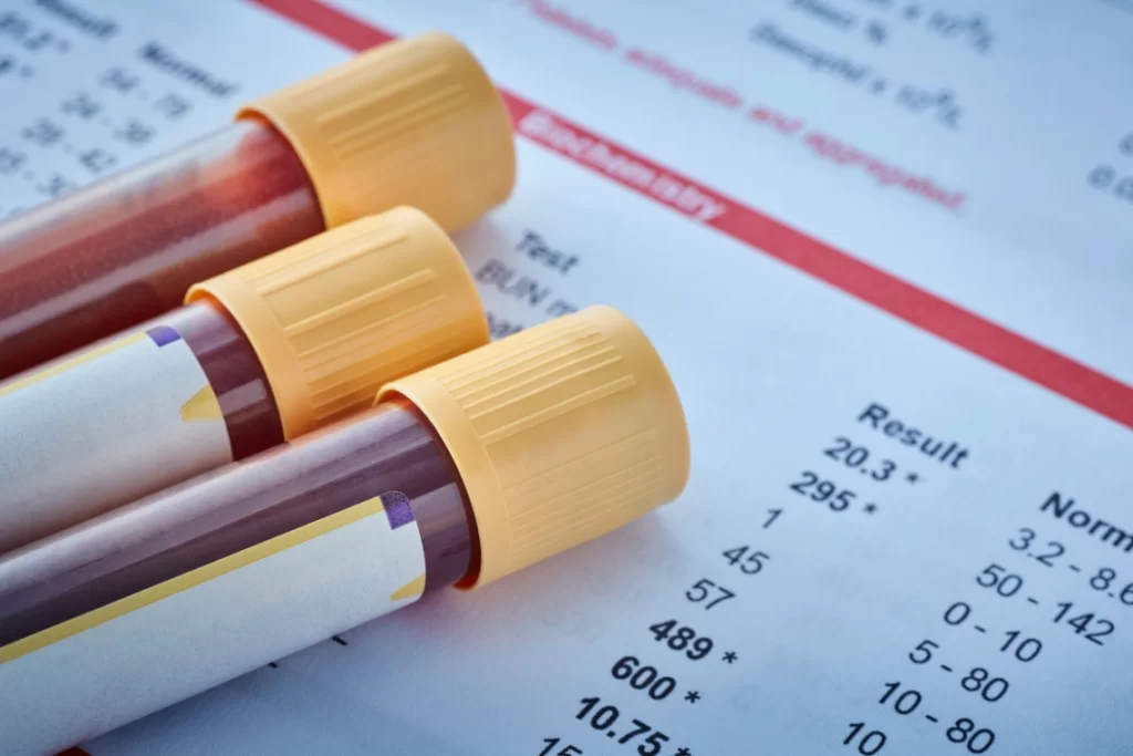تحليل السكر التراكمي HbA1c في الأردن – فحص متوسط الجلوكوز في الدم خلال 3 أشهر في مختبر يوني لابز